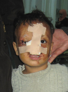 Ibrahim 3 Jahre alt